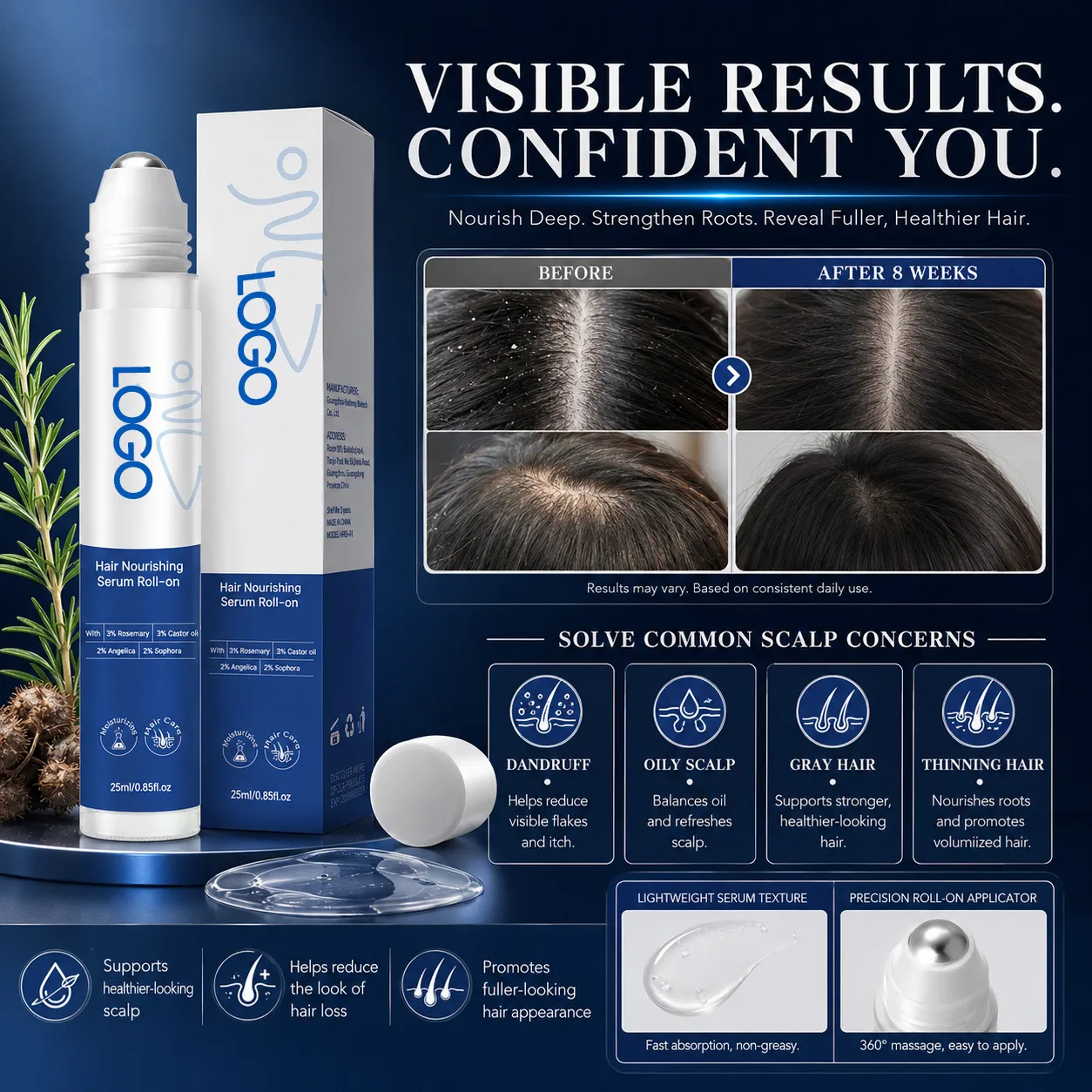 Rosemary Castor Oil Hair Nourishing Serum Roll-On for Scalp Care – OEM/ODM Custom Formula