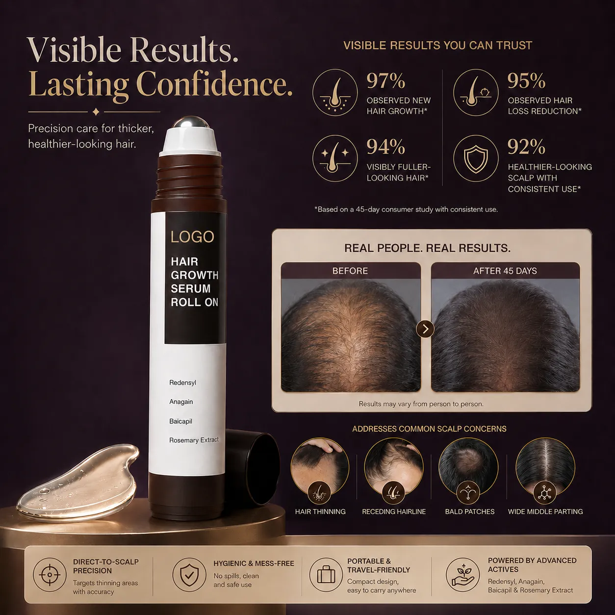 Hair Growth Serum Roll-On with Redensyl Anagain Baicapil & Rosemary Extract – OEM/ODM Custom Formula